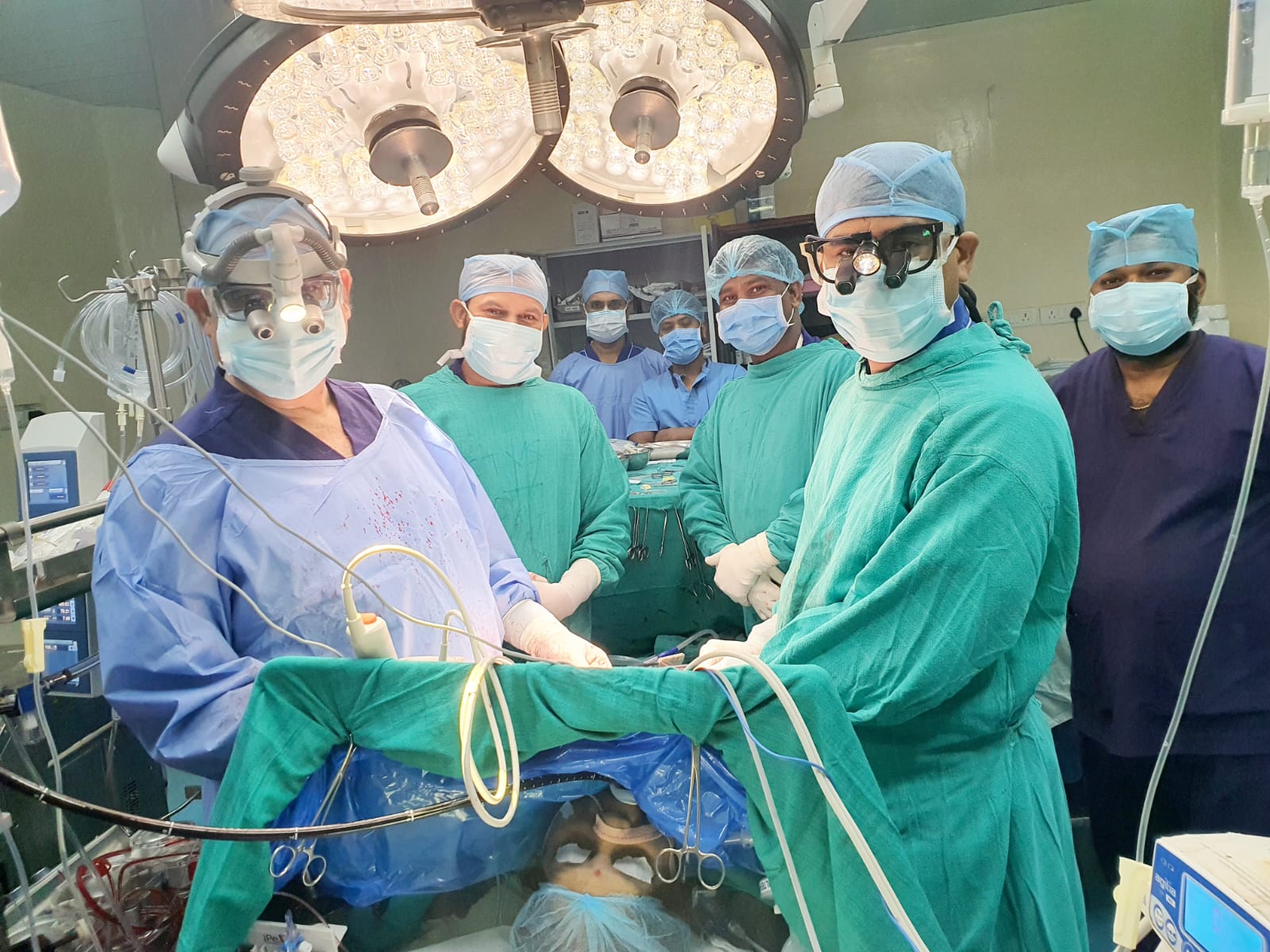 डॉ. भीमराव अम्बेडकर स्मृति चिकित्सालय, रायपुर*  *छ.ग. एवं मध्य भारत में पहली बार* *बिना टांका लगाये (सुचरलेस वाल्व) बायोप्रोस्थेटिक एओटिक हार्ट वाल्व का अम्बेडकर अस्पताल के हार्ट सर्जरी विभाग में सफल प्रत्यारोपण*